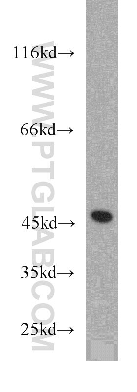 Western Blot (WB) analysis of human brain tissue using PANK2 Polyclonal antibody (11001-1-AP)