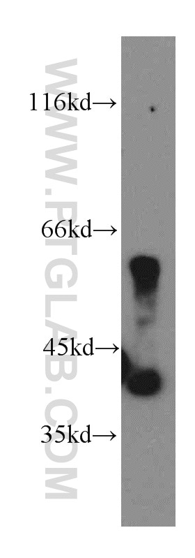 Western Blot (WB) analysis of HepG2 cells using PANK1/2/3 Polyclonal antibody (12466-1-AP)