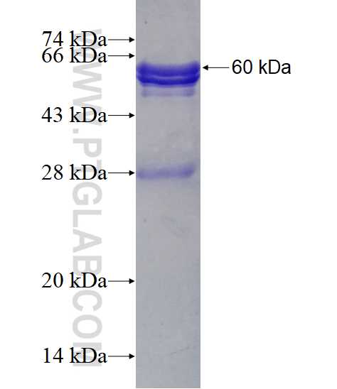 PANK3 fusion protein Ag3140 SDS-PAGE
