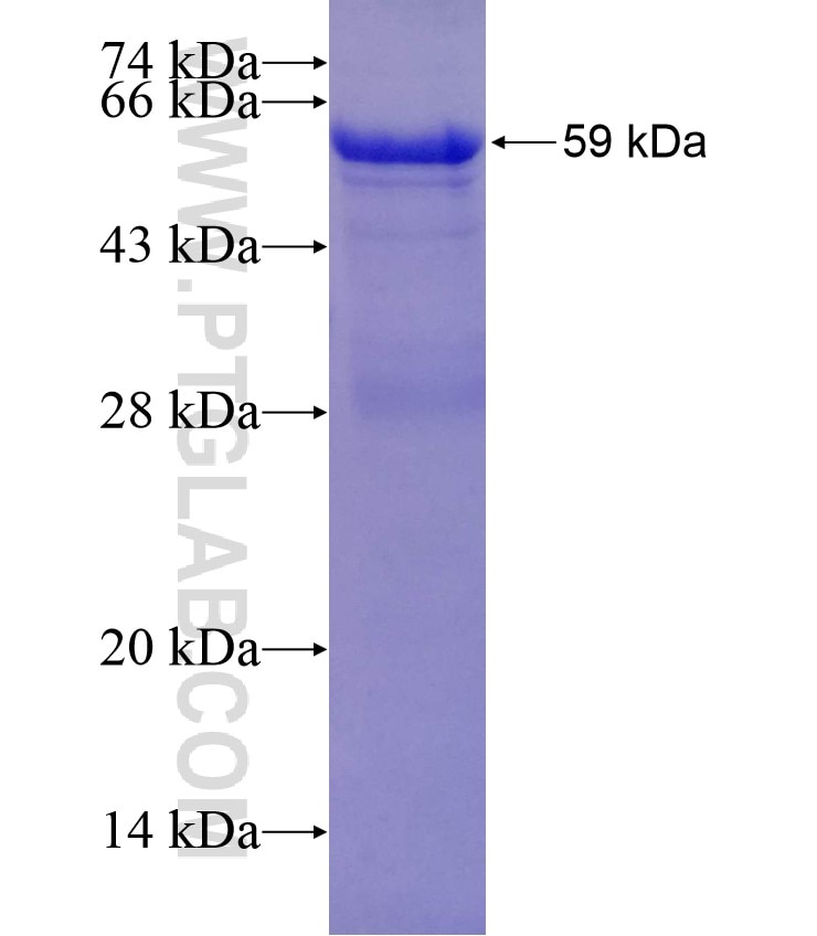 PANX1 fusion protein Ag3174 SDS-PAGE