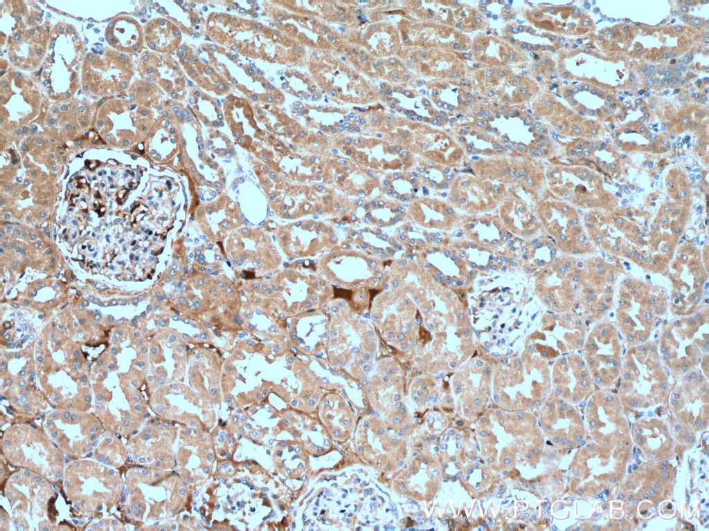 Immunohistochemistry (IHC) staining of human kidney tissue using PANX2 Polyclonal antibody (26604-1-AP)
