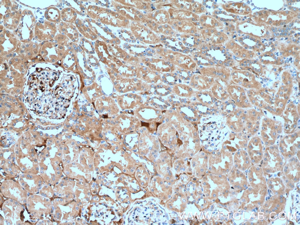 IHC staining of human kidney using 26604-1-AP