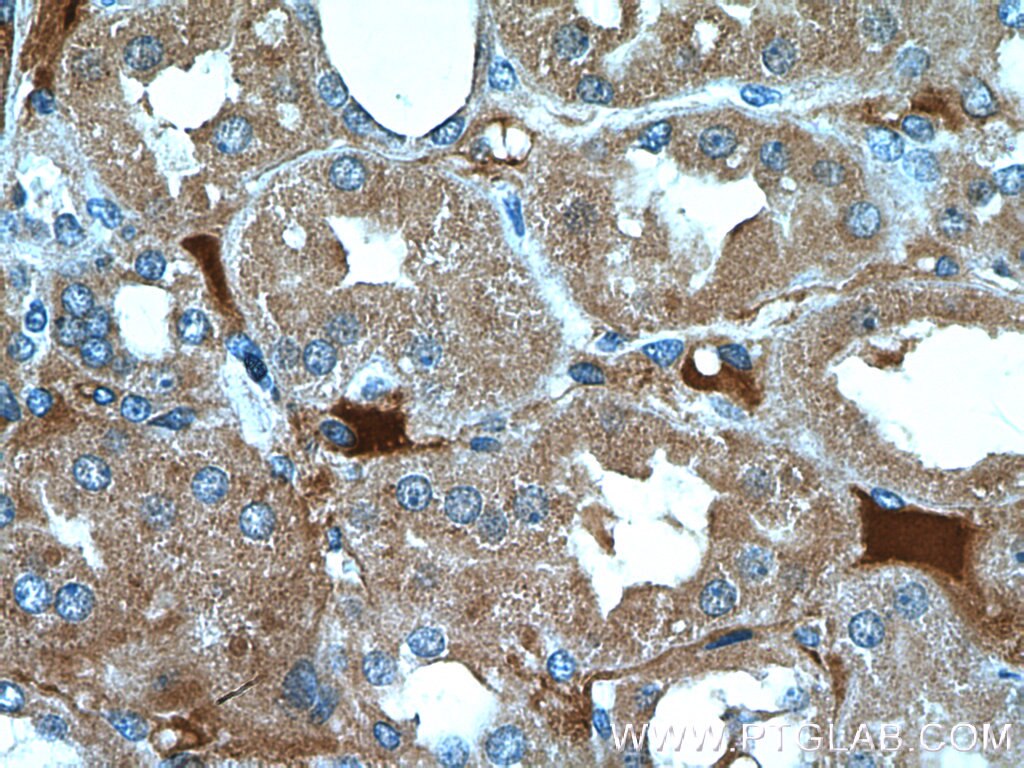 Immunohistochemistry (IHC) staining of human kidney tissue using PANX2 Polyclonal antibody (26604-1-AP)