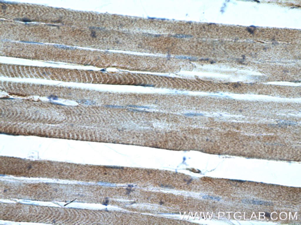 IHC staining of human skeletal muscle using 26604-1-AP