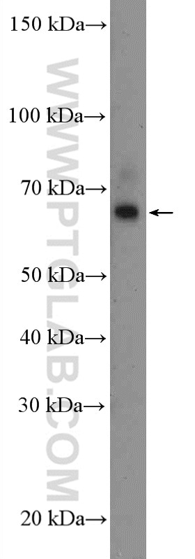Western Blot (WB) analysis of mouse spleen tissue using PANX2 Polyclonal antibody (26604-1-AP)