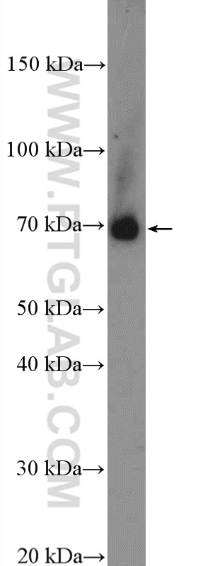 Western Blot (WB) analysis of mouse lung tissue using PANX2 Polyclonal antibody (26604-1-AP)