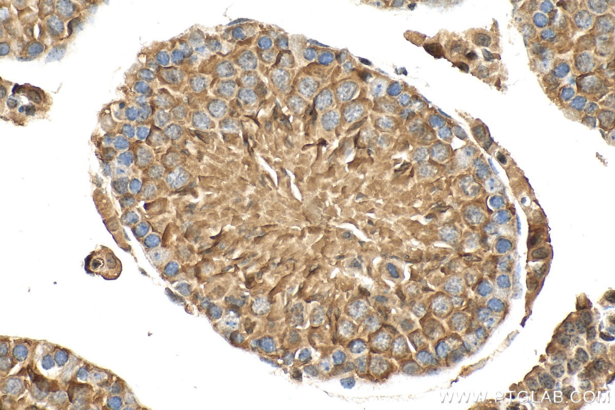Immunohistochemistry (IHC) staining of mouse testis tissue using PAOX Polyclonal antibody (18972-1-AP)