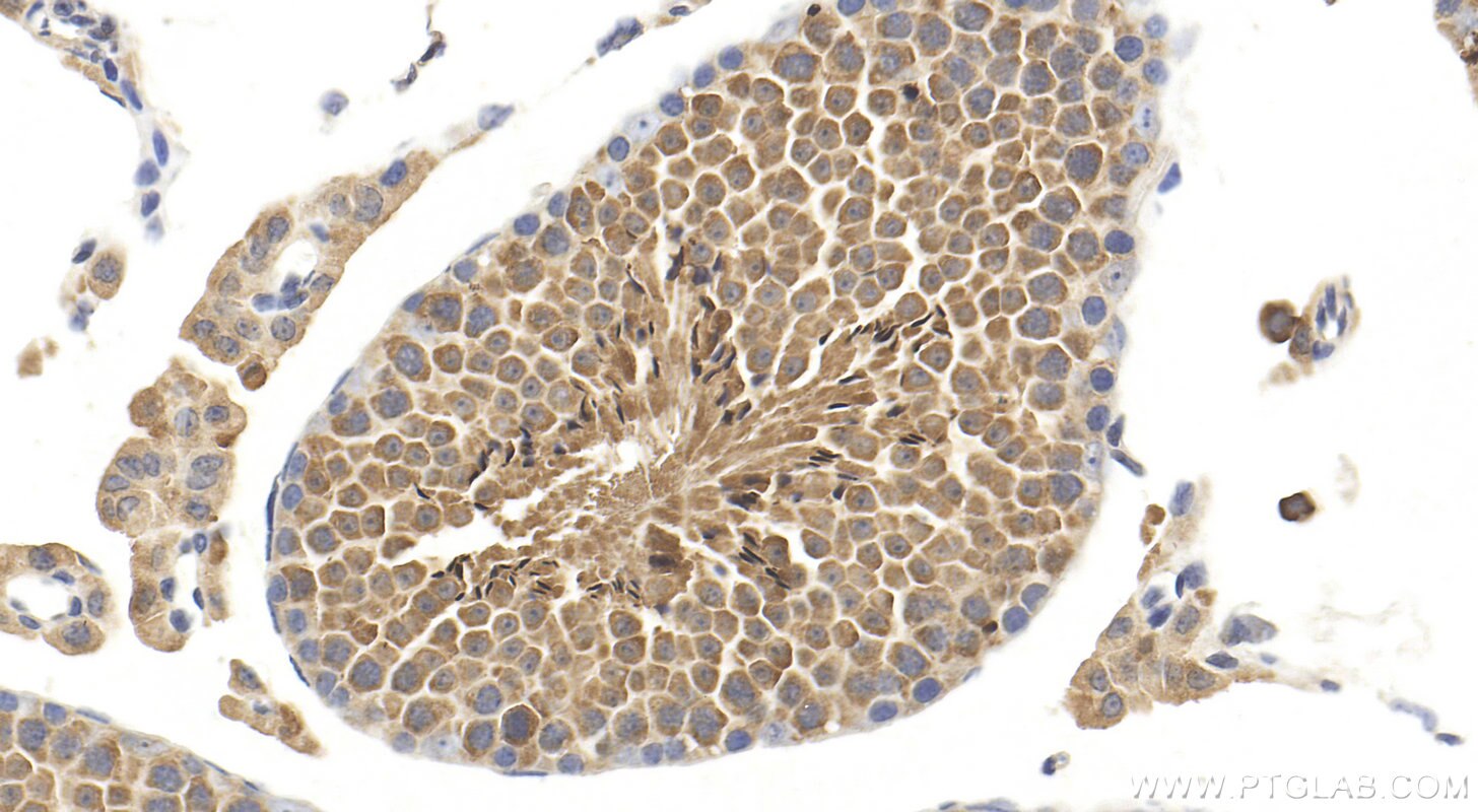 Immunohistochemistry (IHC) staining of mouse testis tissue using PAOX Polyclonal antibody (18972-1-AP)