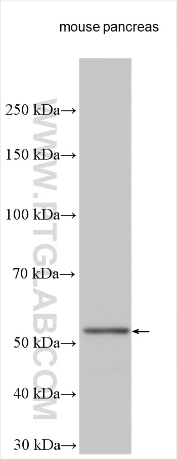 WB analysis using 18972-1-AP