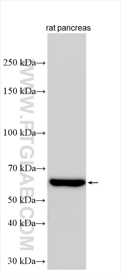 Western Blot (WB) analysis of various lysates using PAOX Polyclonal antibody (18972-1-AP) Western Blot (WB) analysis of various lysates using PAOX Polyclonal antibody (18972-1-AP)