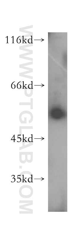 Western Blot (WB) analysis of human stomach tissue using PAOX Polyclonal antibody (18972-1-AP)