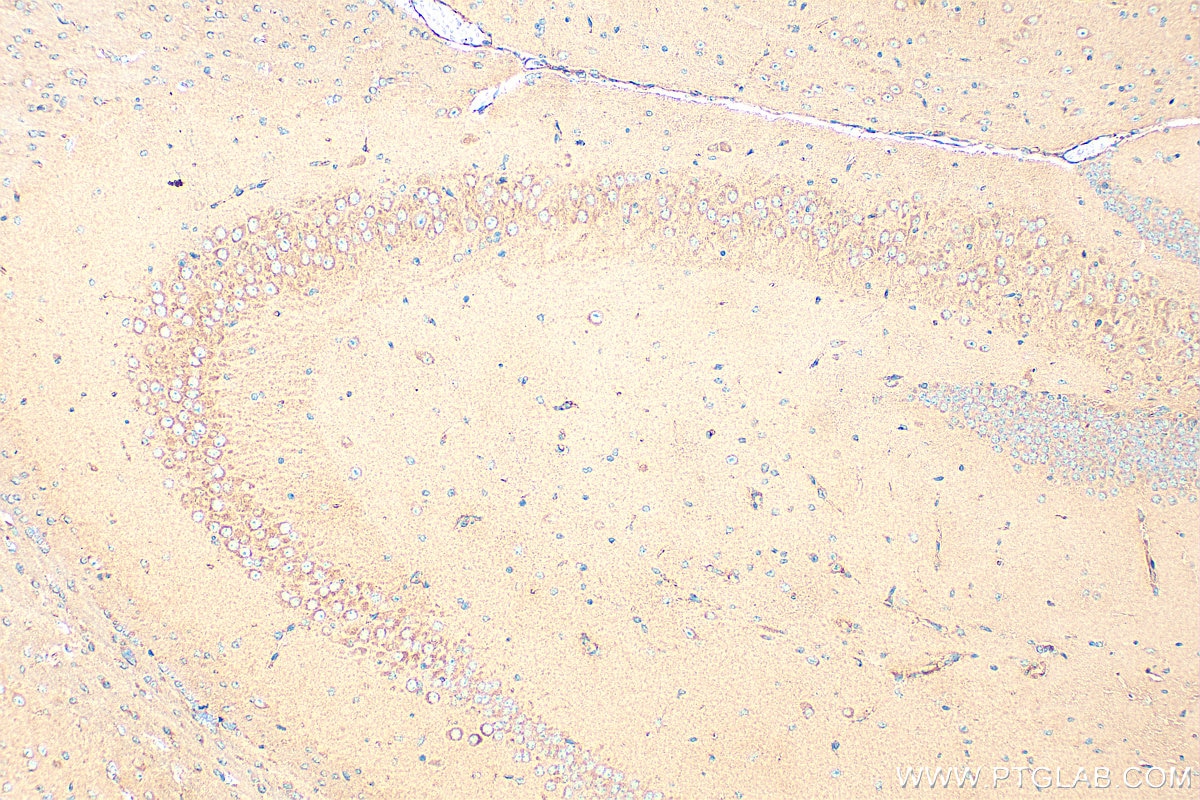 Immunohistochemistry (IHC) staining of mouse brain tissue using LPPR5 Polyclonal antibody (18842-1-AP)