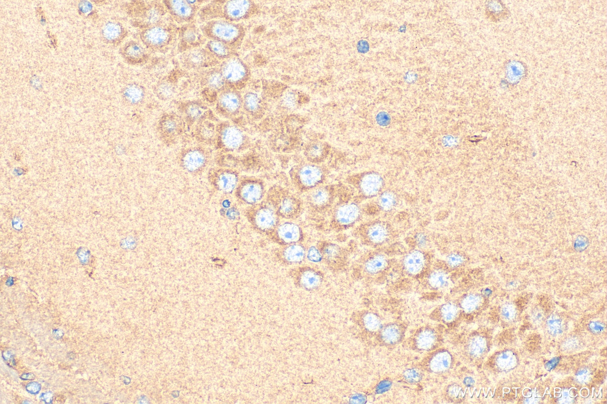 Immunohistochemistry (IHC) staining of mouse brain tissue using LPPR5 Polyclonal antibody (18842-1-AP)