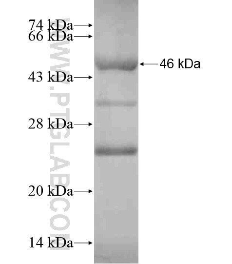 PAPD4 fusion protein Ag18599 SDS-PAGE