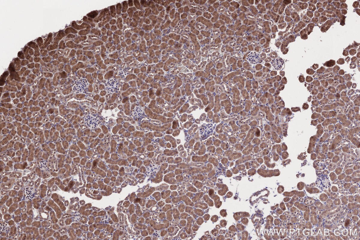 Immunohistochemistry (IHC) staining of mouse kidney tissue using PAPD5 Polyclonal antibody (55197-1-AP)