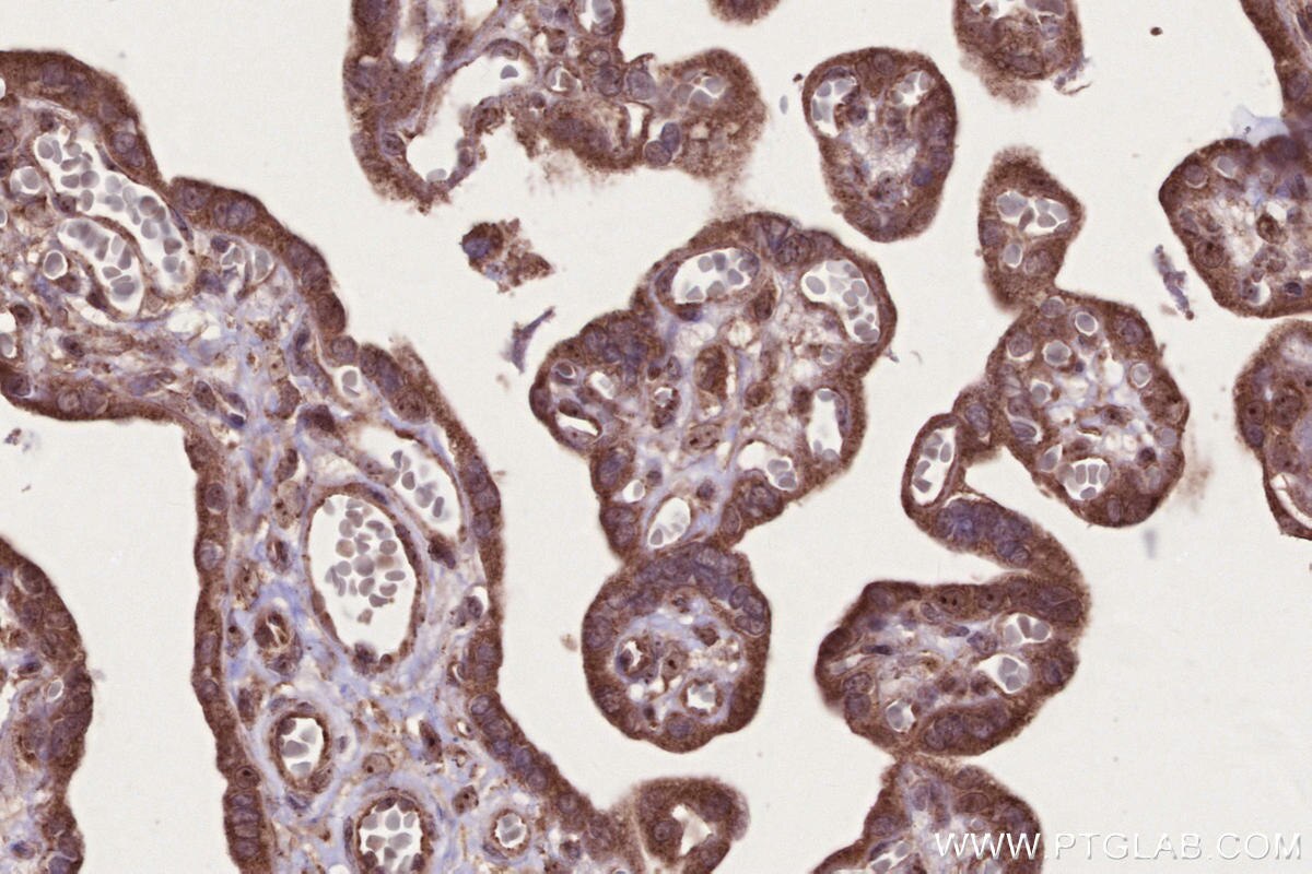Immunohistochemistry (IHC) staining of human placenta tissue using PAPD5 Polyclonal antibody (55197-1-AP)
