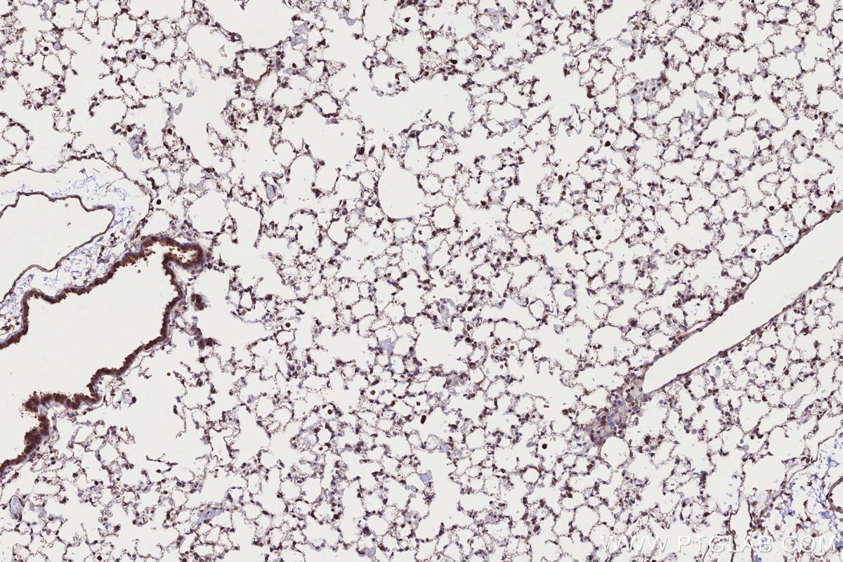 Immunohistochemistry (IHC) staining of mouse lung tissue using PAPD5 Polyclonal antibody (55197-1-AP)