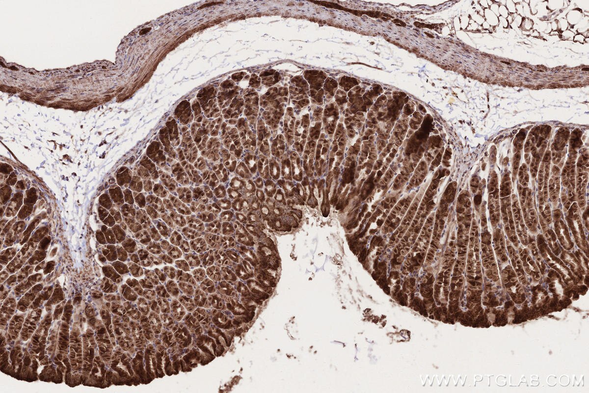 Immunohistochemistry (IHC) staining of mouse stomach tissue using PAPD5 Polyclonal antibody (55197-1-AP)