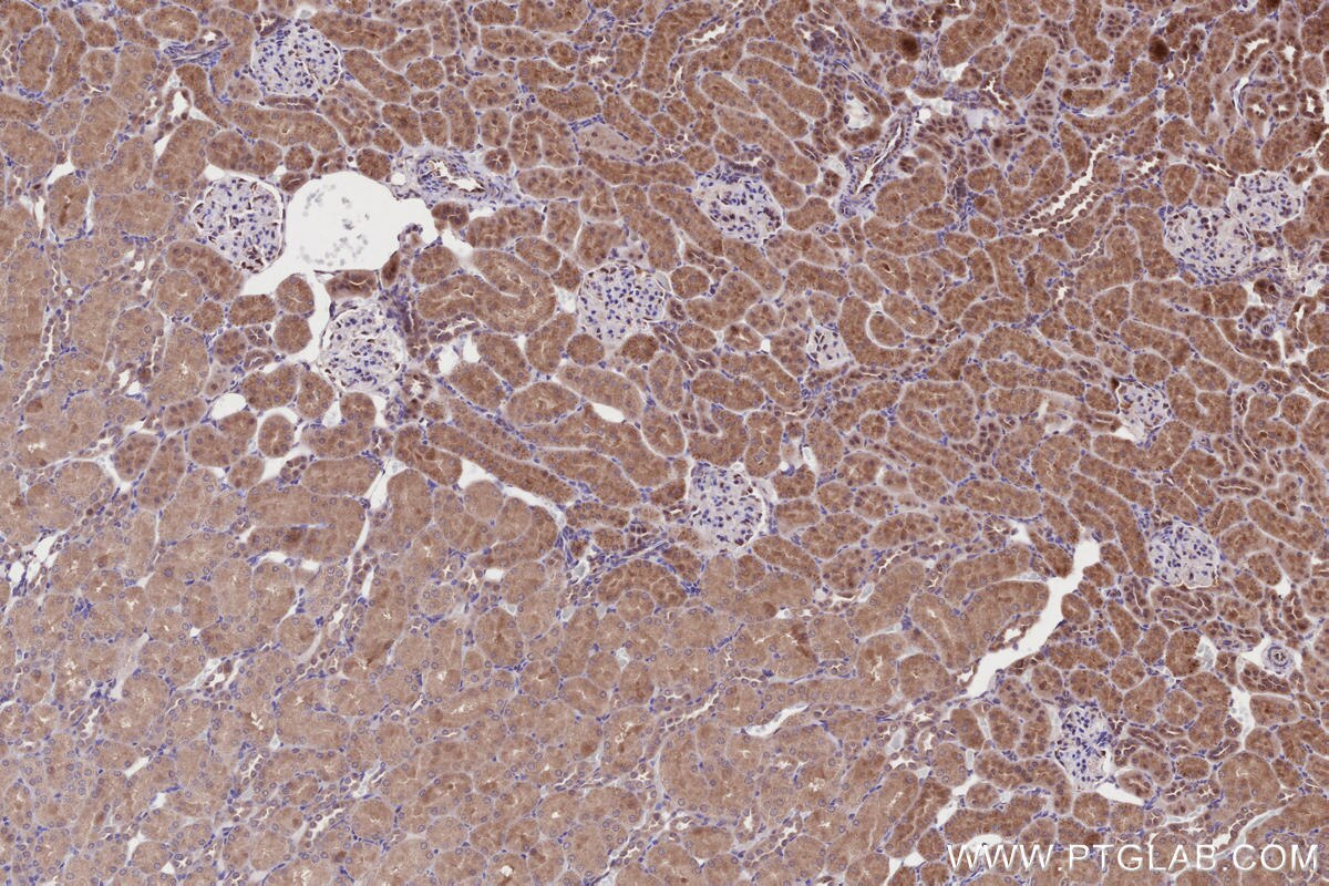 Immunohistochemistry (IHC) staining of rat kidney tissue using PAPD5 Polyclonal antibody (55197-1-AP)