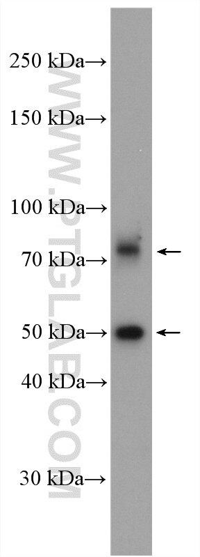 Western Blot (WB) analysis of HepG2 cells using PAPD5 Polyclonal antibody (55197-1-AP)