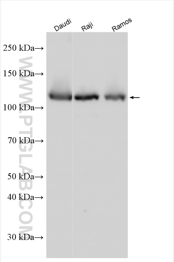 Western Blot (WB) analysis of various lysates using PAPLN Polyclonal antibody (31937-1-AP)
