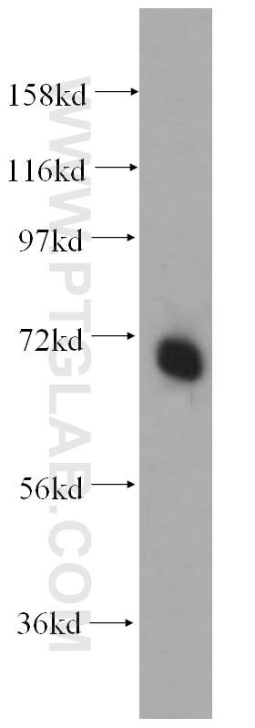 Western Blot (WB) analysis of mouse testis tissue using PAPOLB Polyclonal antibody (12821-1-AP)