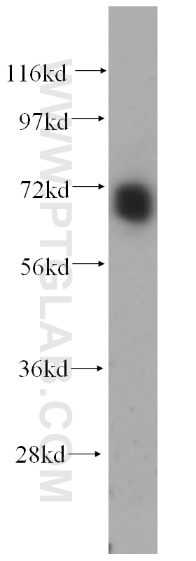 Western Blot (WB) analysis of human kidney tissue using PAPOLB Polyclonal antibody (12821-1-AP)