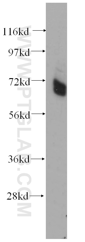 Western Blot (WB) analysis of HeLa cells using PAPOLB Polyclonal antibody (12821-1-AP)