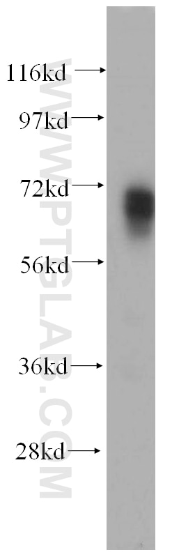 Western Blot (WB) analysis of human brain tissue using PAPOLB Polyclonal antibody (12821-1-AP)