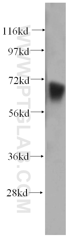 Western Blot (WB) analysis of human stomach tissue using PAPOLB Polyclonal antibody (12821-1-AP)