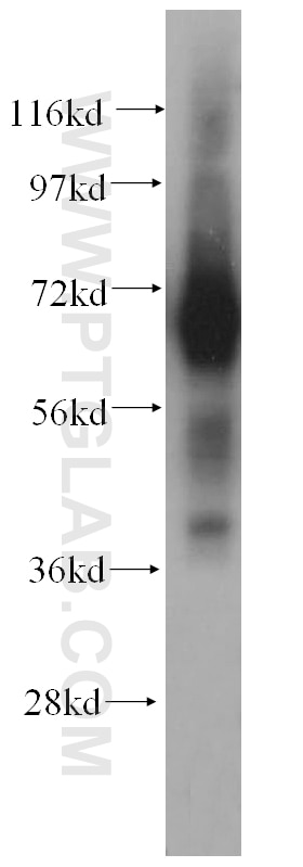 Western Blot (WB) analysis of human placenta tissue using PAPOLB Polyclonal antibody (12821-1-AP)
