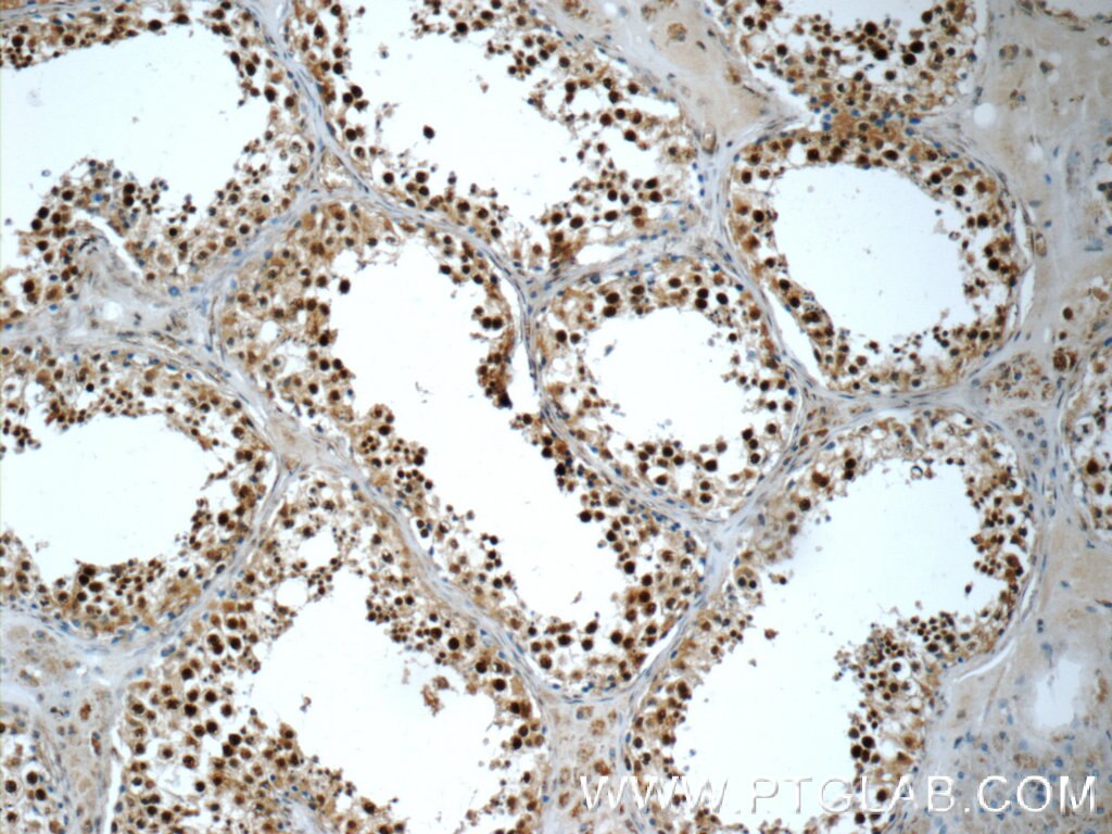 Immunohistochemistry (IHC) staining of human testis tissue using PAPOLG Polyclonal antibody (24284-1-AP)