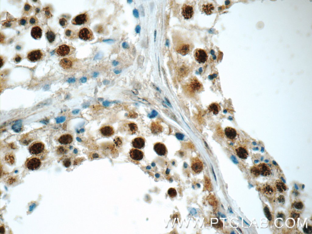 Immunohistochemistry (IHC) staining of human testis tissue using PAPOLG Polyclonal antibody (24284-1-AP)