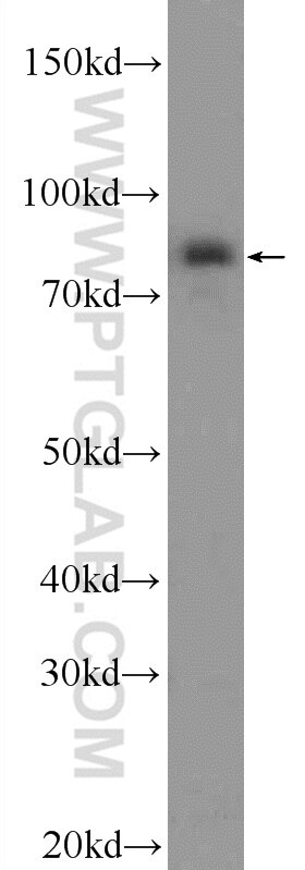 Western Blot (WB) analysis of HeLa cells using PAPOLG Polyclonal antibody (24284-1-AP)