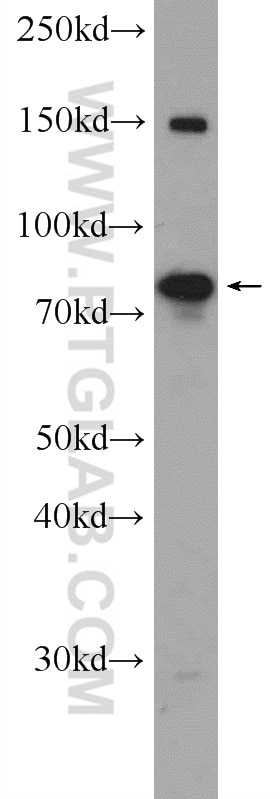 Western Blot (WB) analysis of MCF-7 cells using PAPOLG Polyclonal antibody (24284-1-AP)