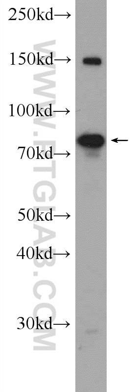 WB analysis of MCF-7 using 24284-1-AP