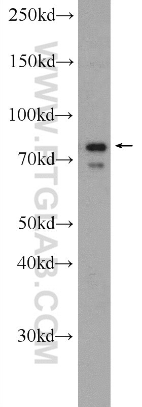 Western Blot (WB) analysis of MCF-7 cells using PAPOLG Polyclonal antibody (24284-1-AP)