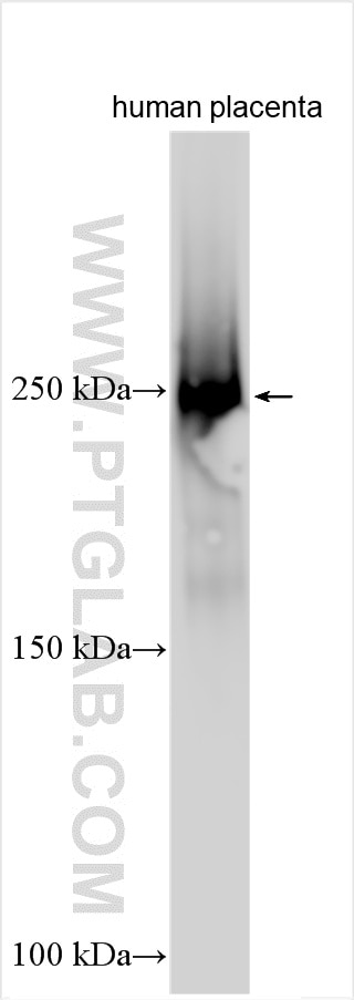 Human placenta tissue were subjected to SDS PAGE followed by western blot with 33013-1-AP (PAPP A2 antibody) at dilution of 1:1000 incubated at room temperature for 1.5 hours. Western Blot (WB) analysis of various lysates using PAPP A2 Polyclonal antibody (33013-1-AP)