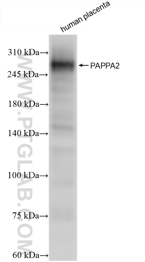 human placenta tissue were subjected to SDS PAGE followed by western blot with 85976-3-RR (PAPPA2 antibody) at dilution of 1:5000 incubated at room temperature for 1.5 hours. Western Blot (WB) analysis of human placenta tissue using PAPP A2 Recombinant antibody (85976-3-RR)