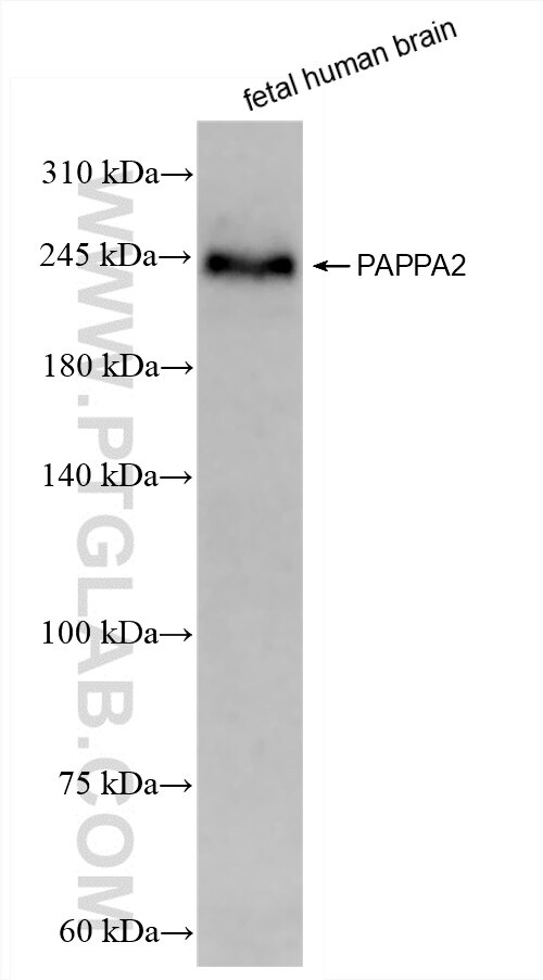 fetal human brain tissue were subjected to SDS PAGE followed by western blot with 85976-3-RR (PAPPA2 antibody) at dilution of 1:5000 incubated at room temperature for 1.5 hours. Western Blot (WB) analysis of fetal human brain tissue using PAPP A2 Recombinant antibody (85976-3-RR)