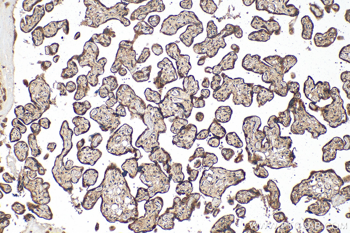 IHC staining of human placenta using 18095-1-AP