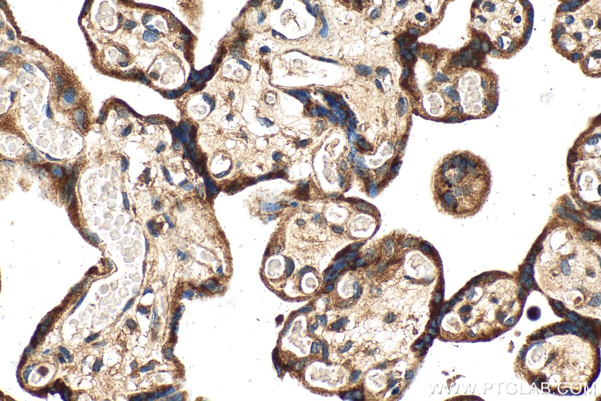 IHC staining of human placenta using 18095-1-AP