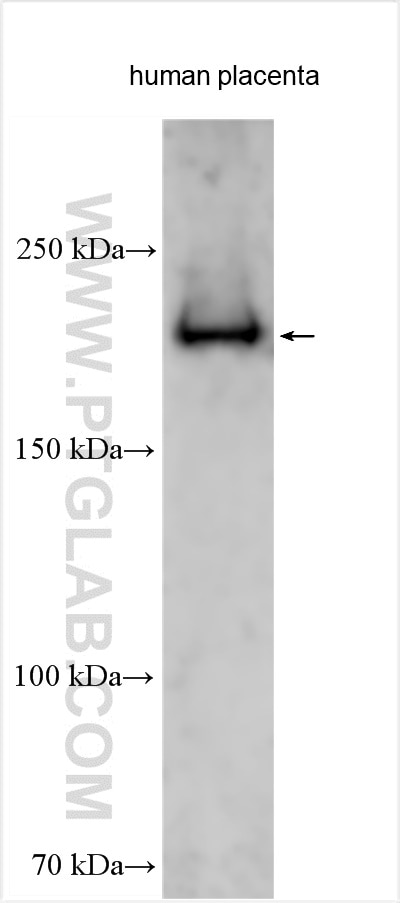Western Blot (WB) analysis of various lysates using PAPPA Polyclonal antibody (18095-1-AP)