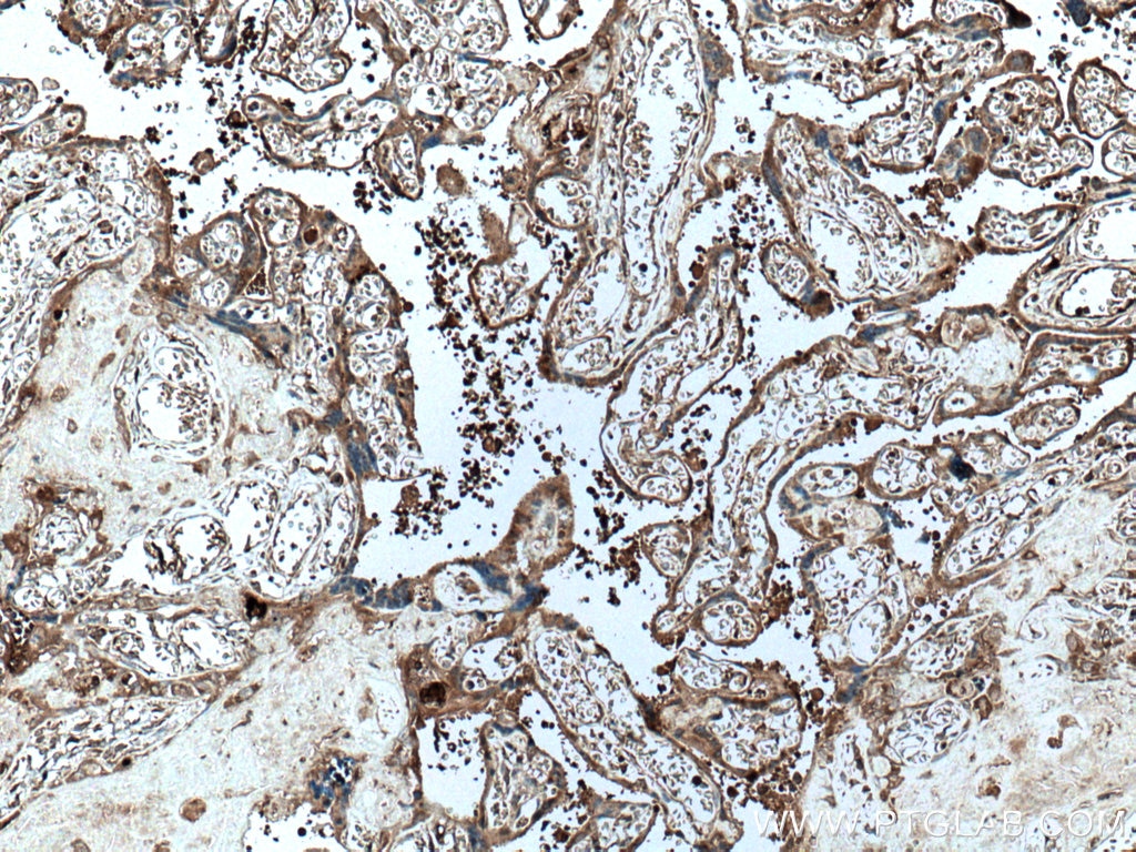 Immunohistochemistry (IHC) staining of human placenta tissue using PAPPA Monoclonal antibody (66962-1-Ig)
