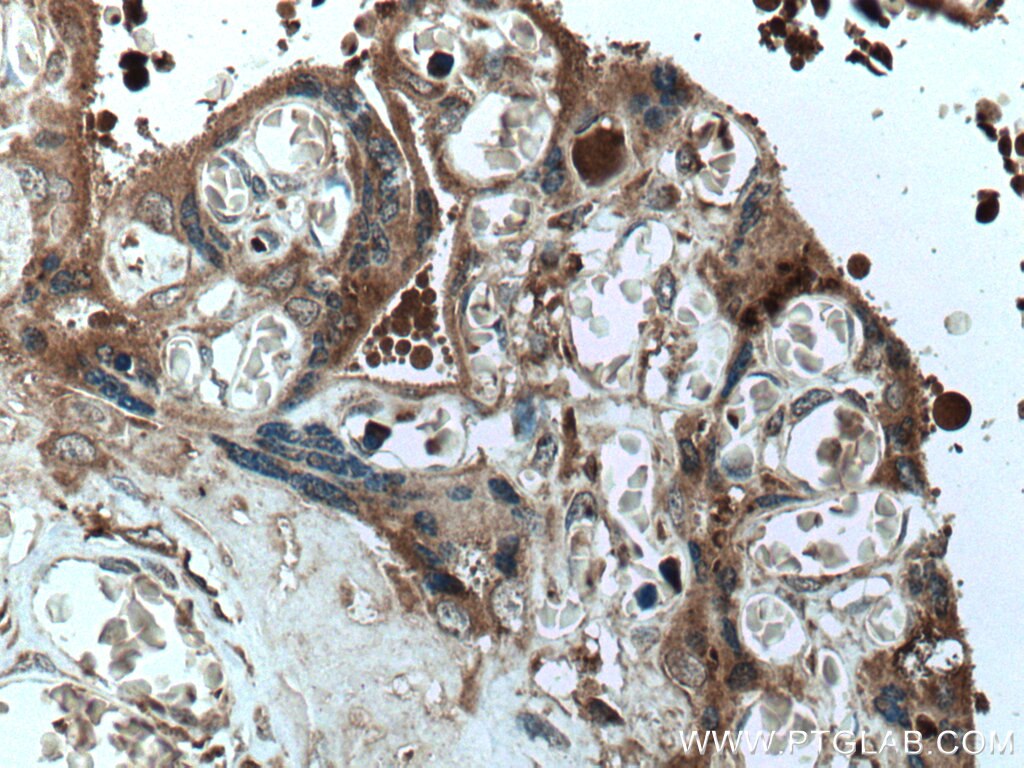 Immunohistochemistry (IHC) staining of human placenta tissue using PAPPA Monoclonal antibody (66962-1-Ig)