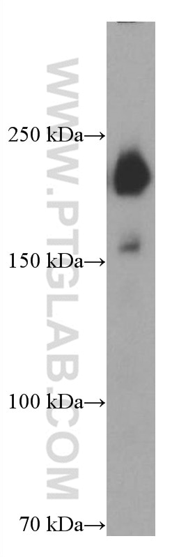Western Blot (WB) analysis of human placenta tissue using PAPPA Monoclonal antibody (66962-1-Ig)