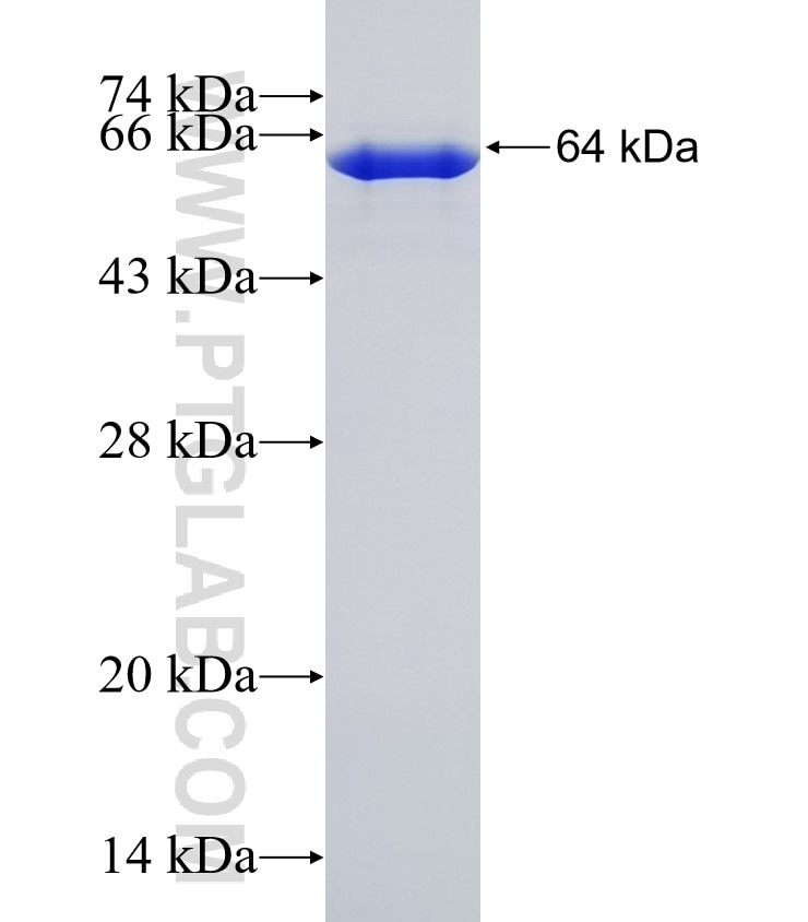 PAPPA2 fusion protein Ag31086 SDS-PAGE