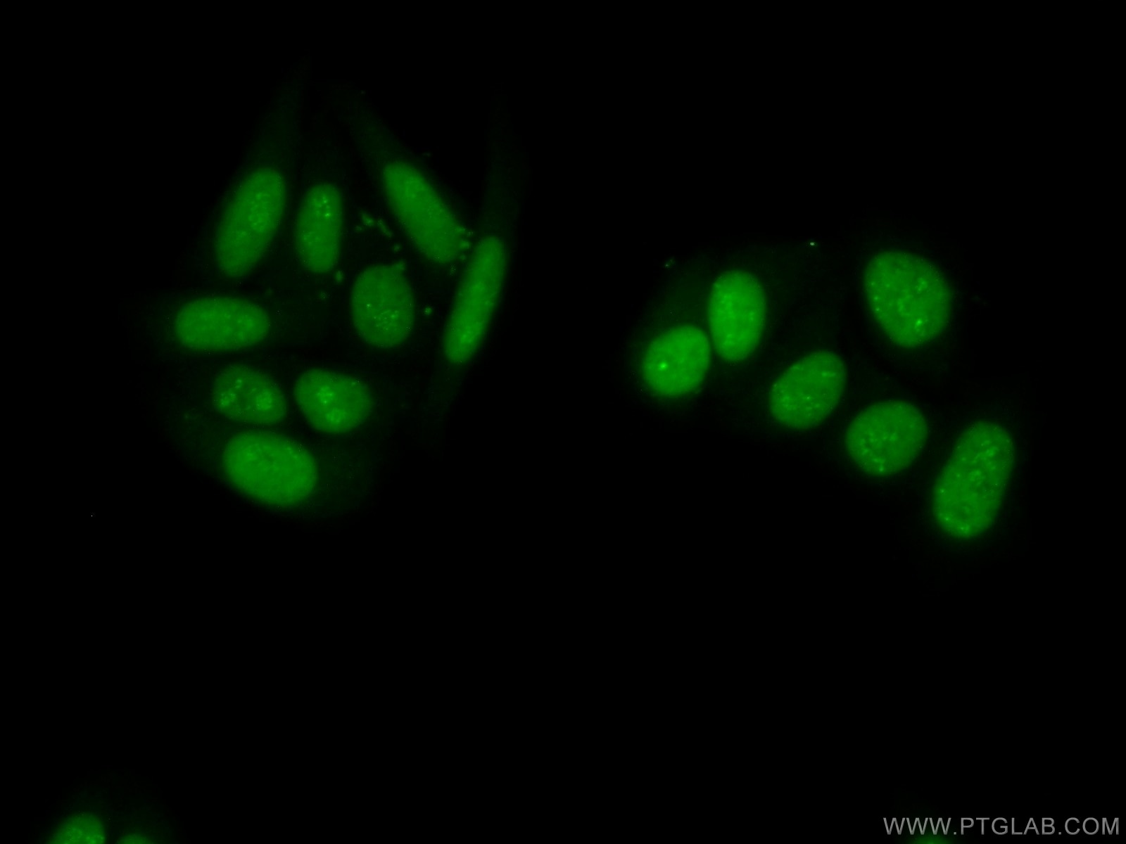 Immunofluorescence (IF) / fluorescent staining of HepG2 cells using PAPSS1 Polyclonal antibody (14708-1-AP)