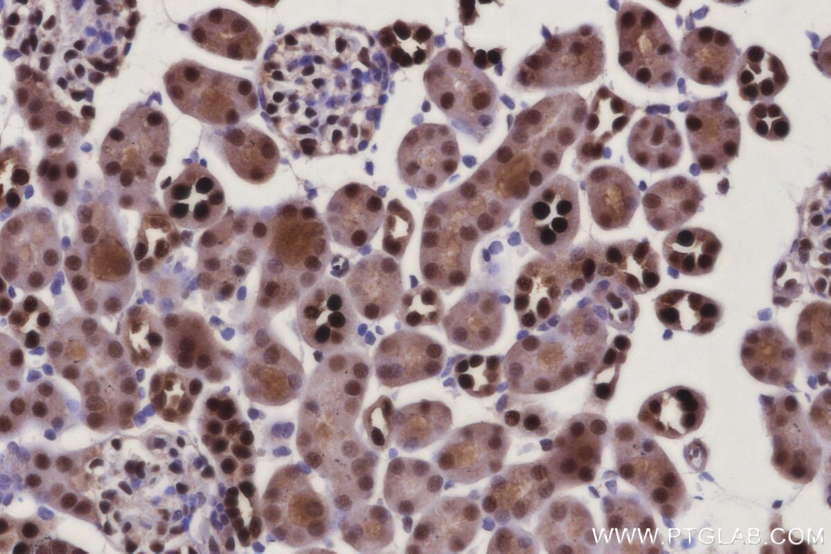 IHC staining of mouse kidney using 14708-1-AP Immunohistochemistry (IHC) staining of mouse kidney tissue using PAPSS1 Polyclonal antibody (14708-1-AP)