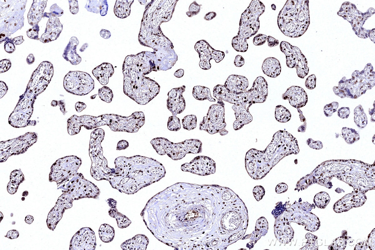 IHC staining of human placenta using 14708-1-AP Immunohistochemistry (IHC) staining of human placenta tissue using PAPSS1 Polyclonal antibody (14708-1-AP)